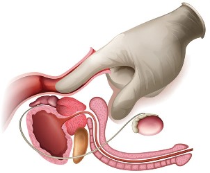 masaža prostate
