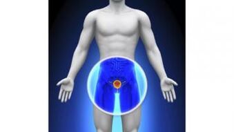 prostatitis u muškarca