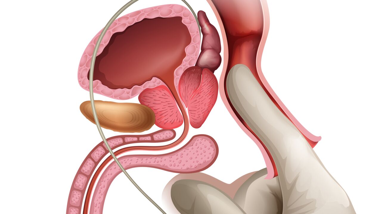 Masaža prostate učinkovit je način liječenja kongestivnog prostatitisa